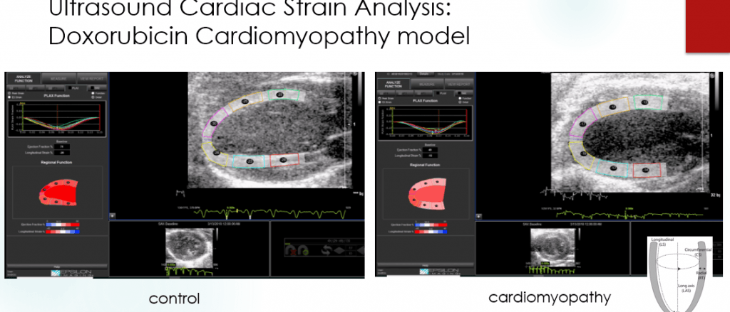 Ultrasound Cardiac Strain Analysis