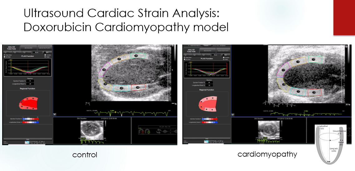Ultrasound Cardiac Strain Analysis