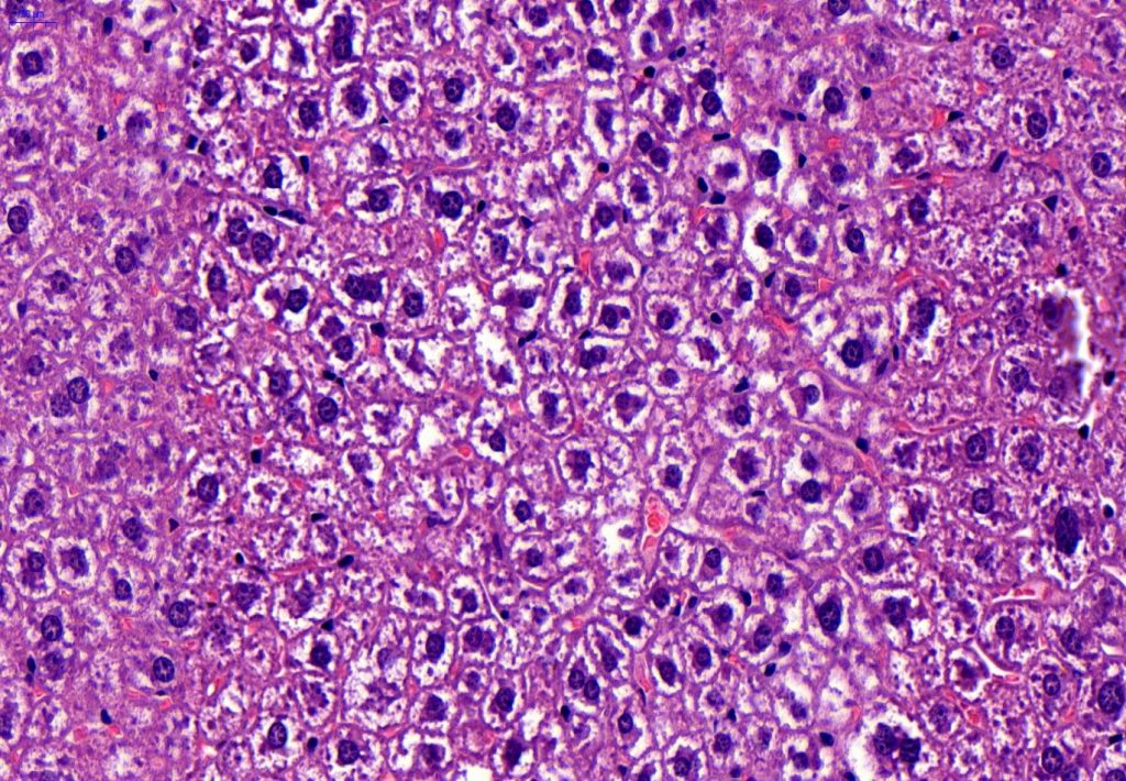 Stained liver sections from normal mouse (NASH Ultrasound Image Analysis)